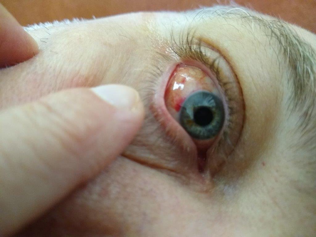 eyeball.jpg