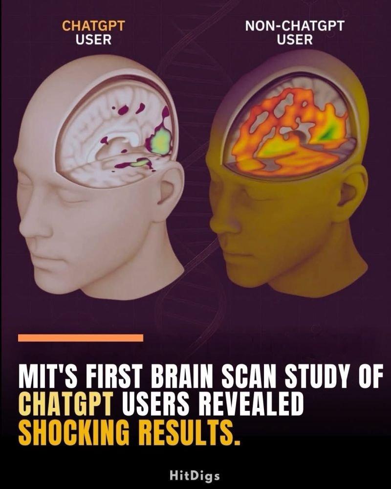 ChatGPT_brain_scan.jpg