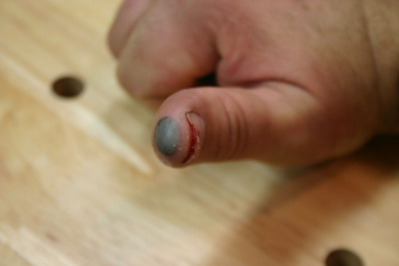 ouch.jpg